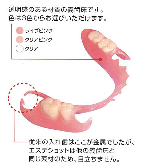 エステショットの構造